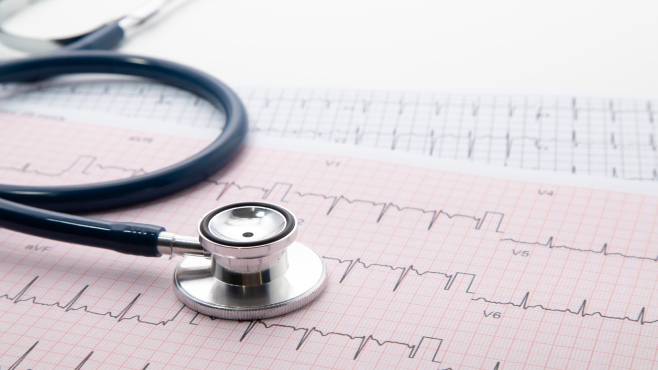 Blue Stethoscope on electrocardiogram (ECG) chart paper. ECG heart chart scan isolate on white. Healthcare insurance and medical background