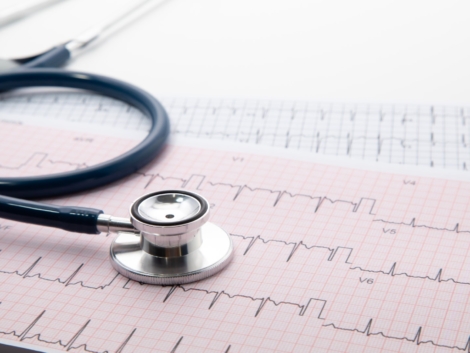 Blue Stethoscope on electrocardiogram (ECG) chart paper. ECG heart chart scan isolate on white. Healthcare insurance and medical background