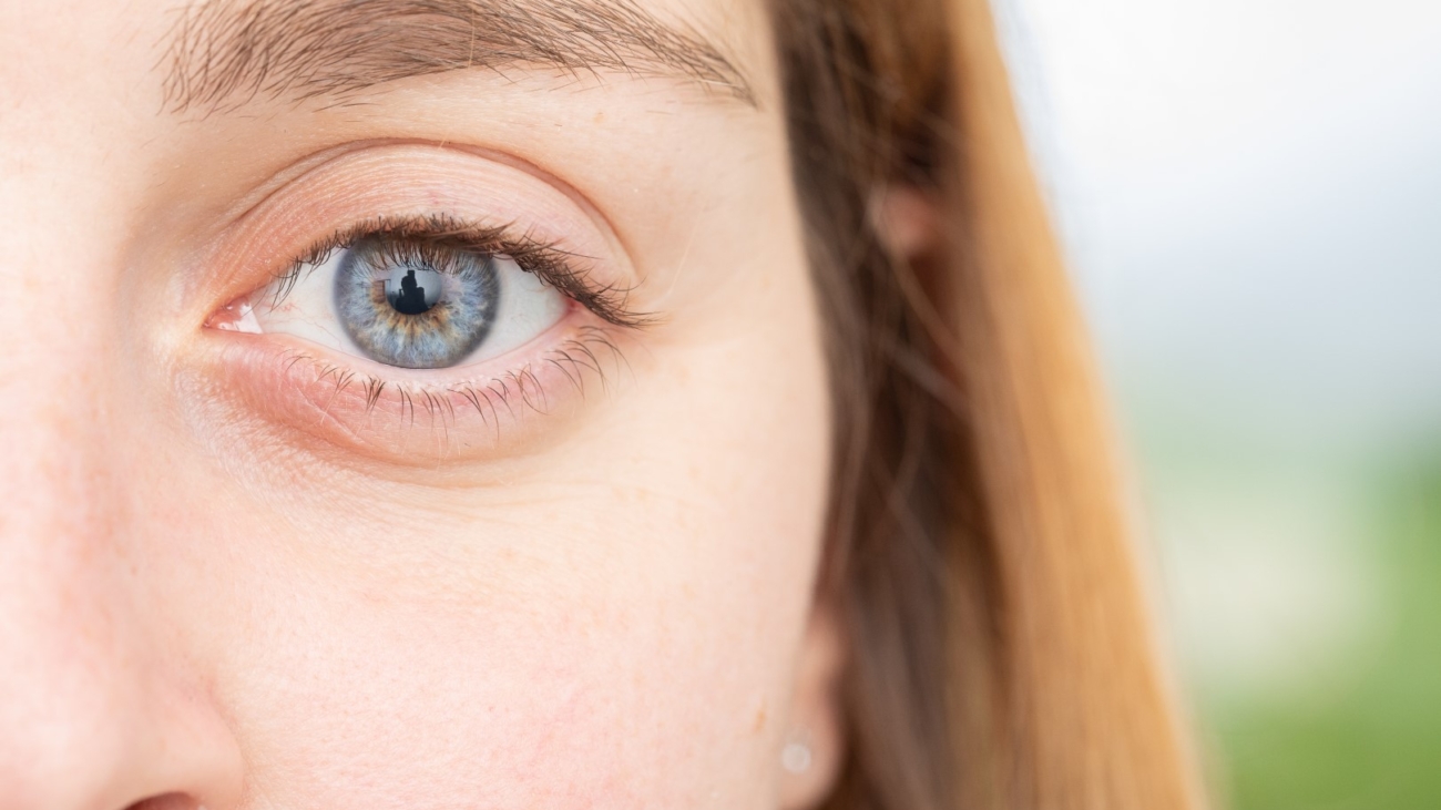 Young woman with wide open eye